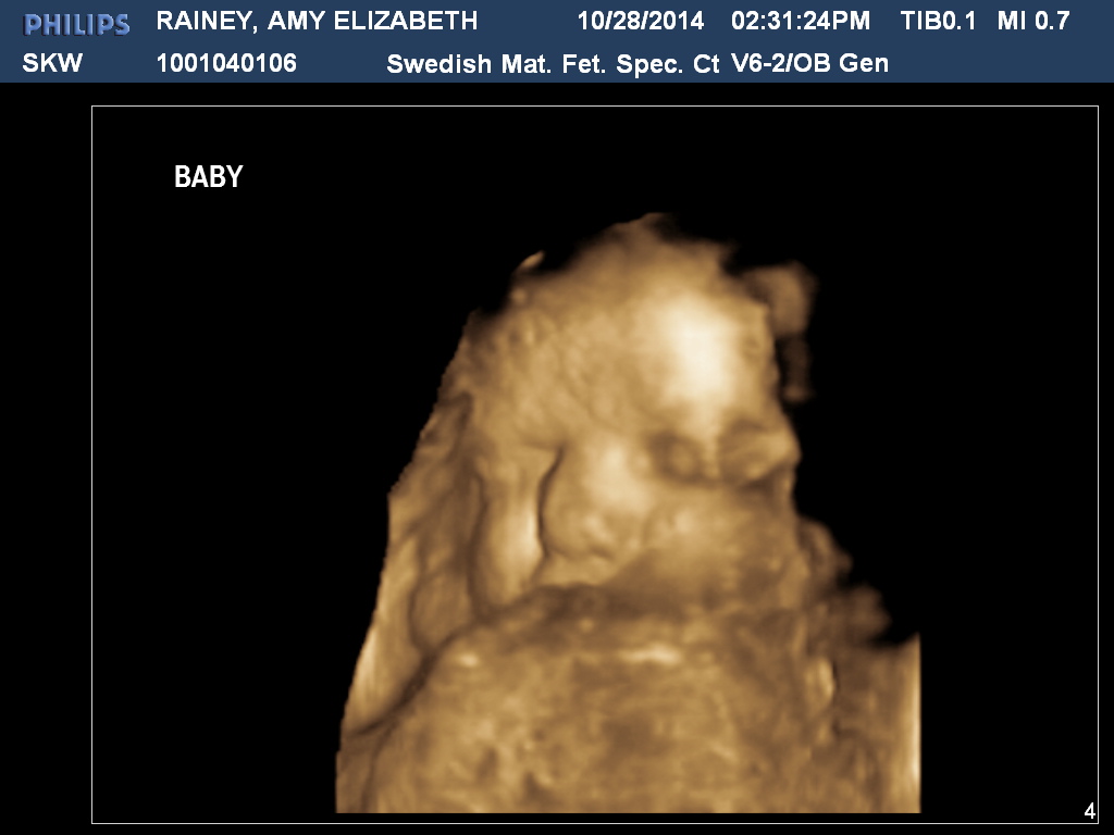 Ultrasound | October 28, 2014